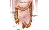 What Happens to Your Body When You Have Crohn’s Disease_ Key Effects Explained