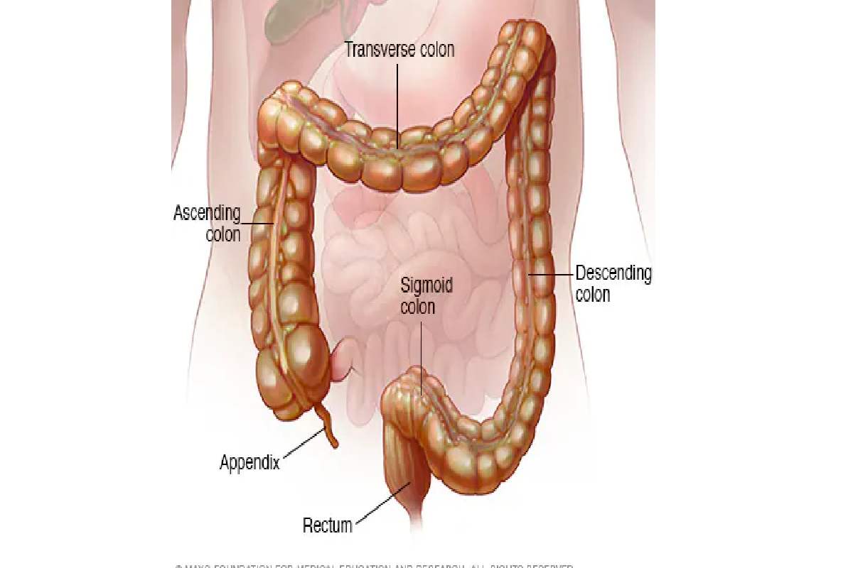 What Happens to Your Body When You Have Crohn’s Disease_ Key Effects Explained
