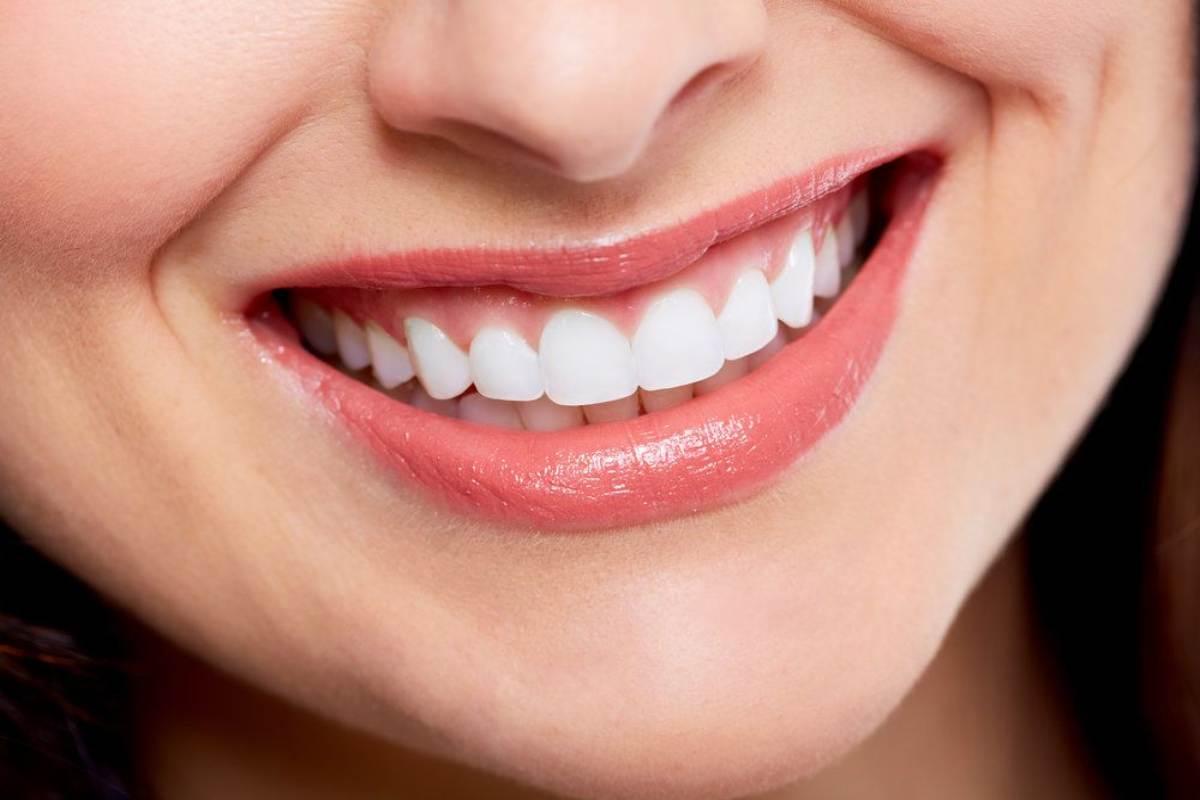 Smile Transformation